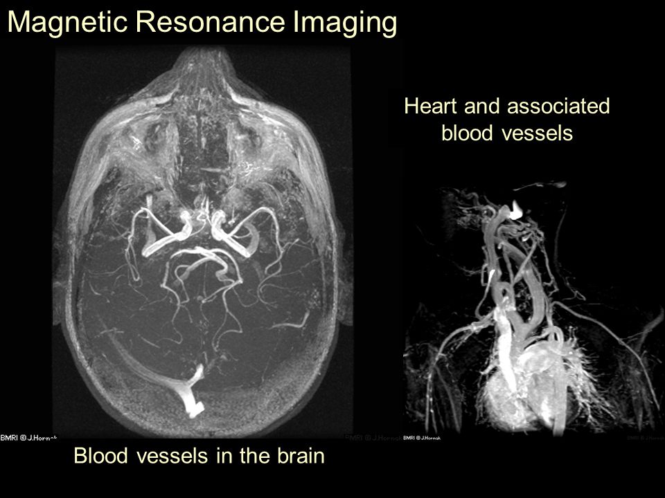 Radiology - Medical Imaging